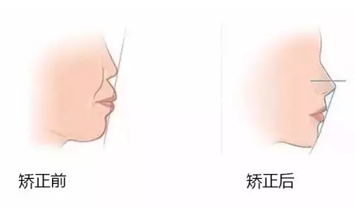 QQ截图20170117140021.png