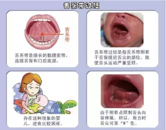 QQ截图20170324162417.png QQ截图20170324162417.png
