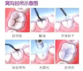 QQ截图20171110152234.png